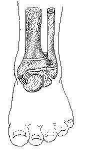 Spiral Of Tillaux